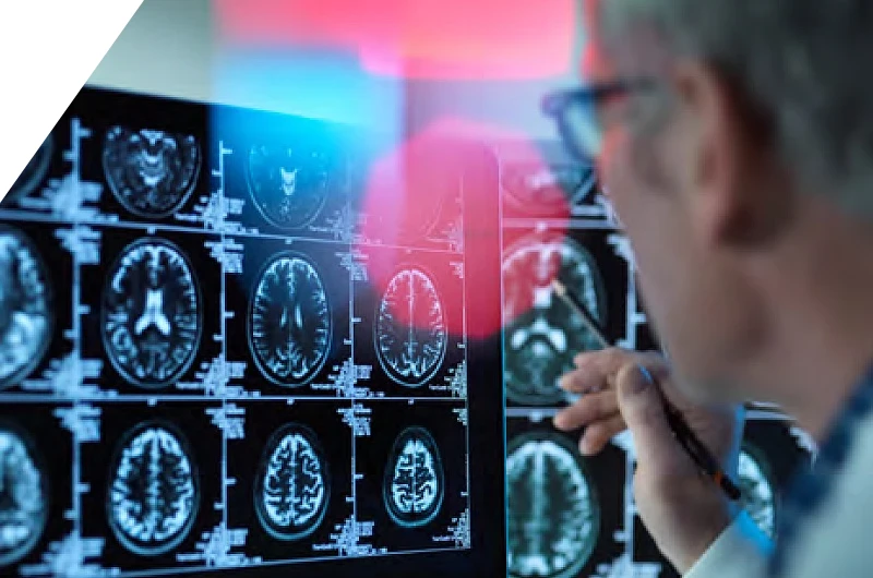 Our Mission – Italfarmaco SpA